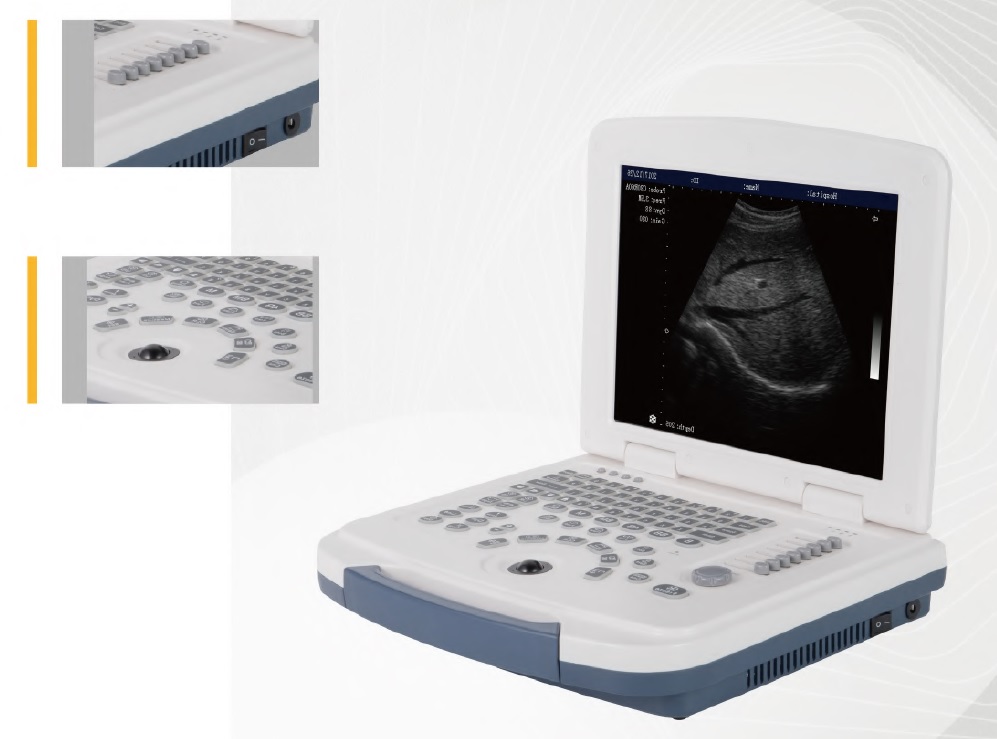 B/W Laptop Type Ultrasound